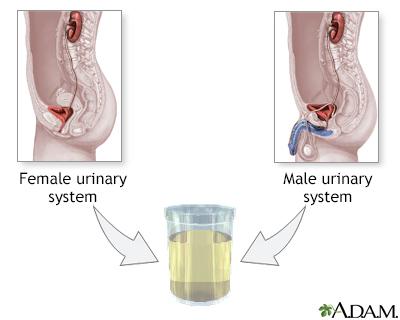 Urine test