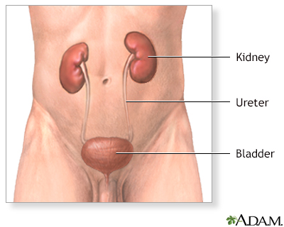 Kidney removal (nephrectomy) - series