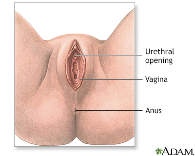 Anterior vaginal wall repair (surgical treatment of urinary incontinence) - series