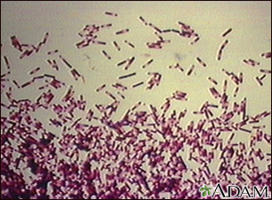 Clostridioides difficile organism