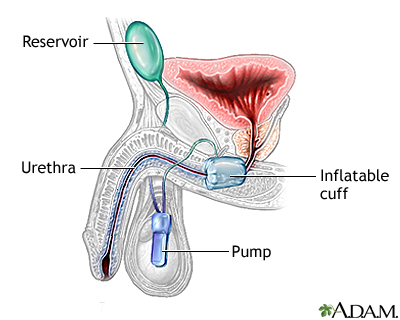 Procedure, part 2