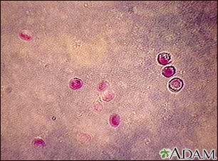 Cryptosporidium - organism