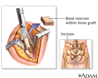 Procedure, part 1