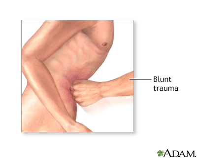 Diagnostic peritoneal lavage - series