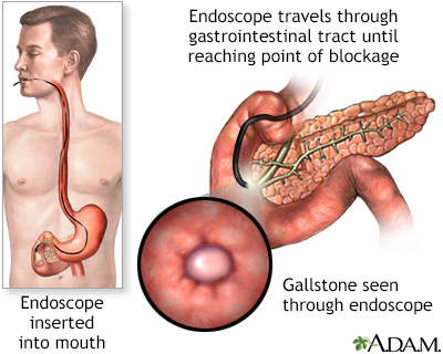 Procedure, part 1