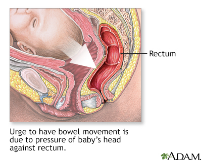 Emergency Childbirth