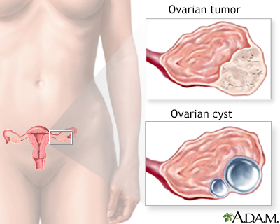 Ovarian growth worries