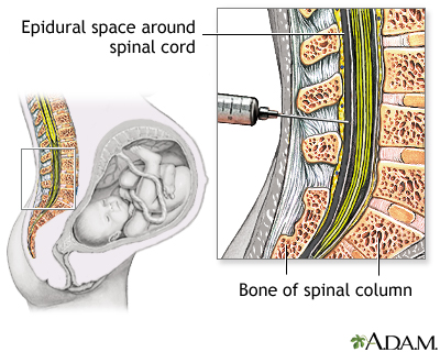 Procedure, part 1