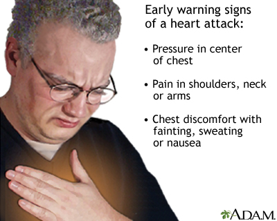 Heart attack symptoms