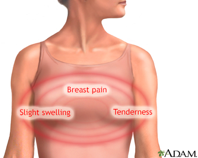 Breast pain