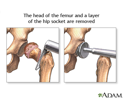 Procedure, part 1