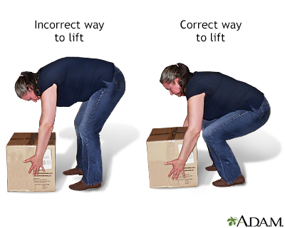 Proper lifting technique