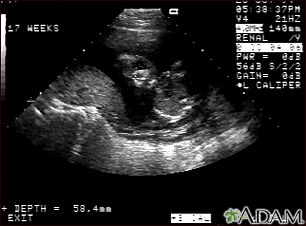 Ultrasound, normal fetus - face