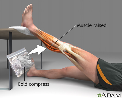 Treatment for leg strain