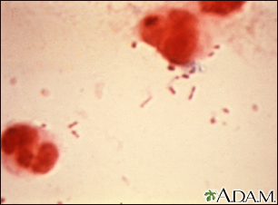 Haemophilus influenzae organism