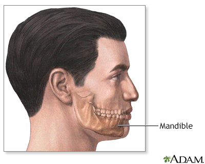 Chin augmentation - series