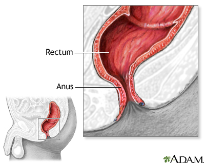 Hemorrhoid surgery - series