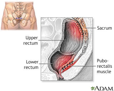 Procedure