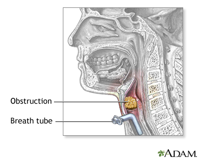 Procedure