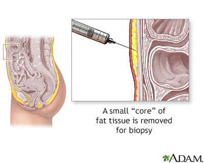 Fat tissue biopsy