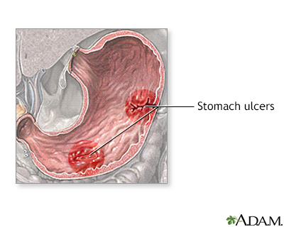 Stomach disease or trauma