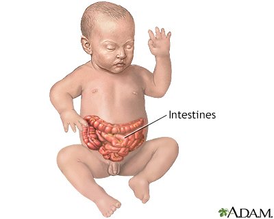 Infant intestines