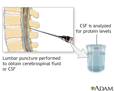 CSF protein test