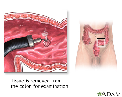 Colon culture