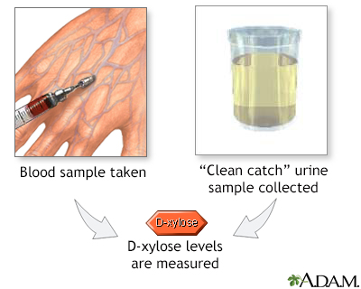 D-xylose level tests