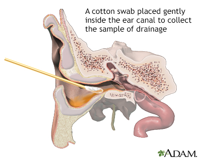 Ear drainage culture