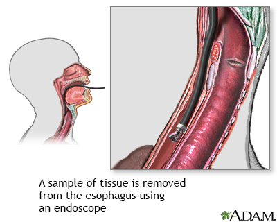 Esophageal tissue culture