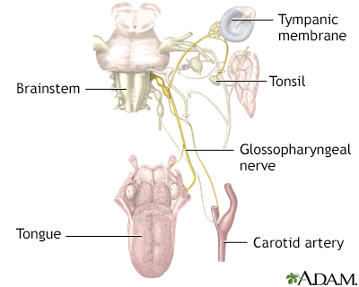 Glossopharyngeal neuralgia