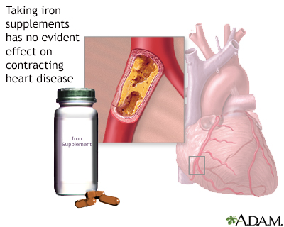 Iron supplements