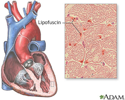 Lipofuscin