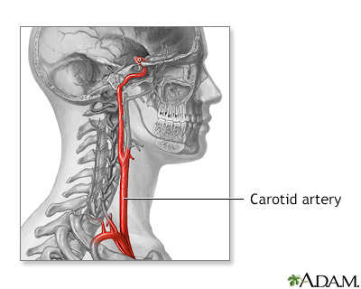 Carotid artery anatomy