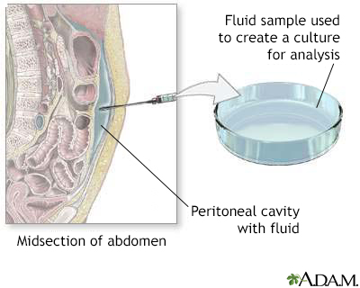 Peritoneal culture