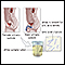 Uric acid test