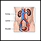 Kidney transplant - series