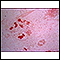 Haemophilus influenza organism