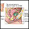 Voiding cystourethrogram