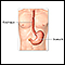 Gastrostomy tube placement - series