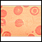 Red blood cells, target cells