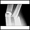 Fracture, forearm - X-ray