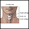 Emergency airway puncture