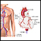 Coronary angiography