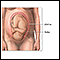 C-Section - Series