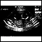 Ultrasound, normal fetus - ventricles of brain