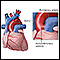 Aortopulmonary window