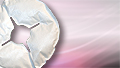 Breast engorgement