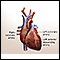 Heart bypass surgery - series